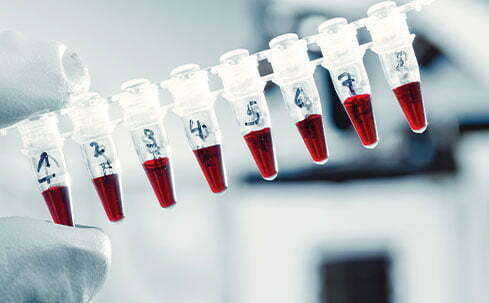 Blood samples.